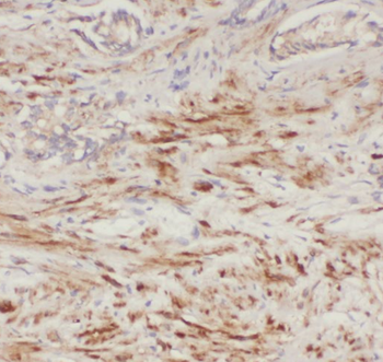 ACP3 Antibody