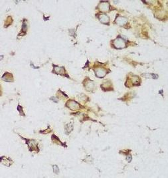 MTDH Antibody