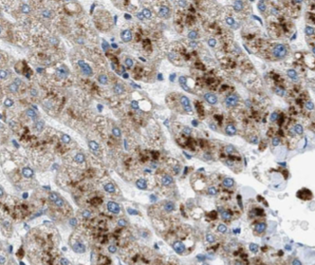 AFM Antibody
