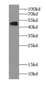 AHCY Antibody