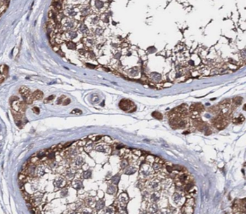 AHCY Antibody