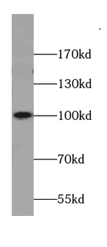 AKAP3 Antibody
