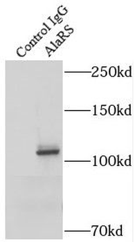 AARS1 Antibody