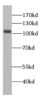 AARS1 Antibody