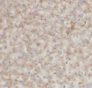 AARS1 Antibody