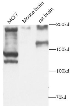 ALK Rabbit Polyclonal Antibody