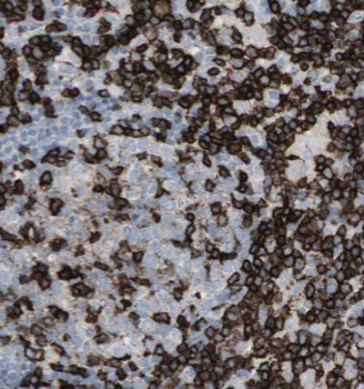 ALK Rabbit Polyclonal Antibody
