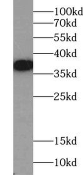 ALK Antibody