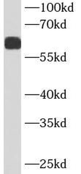 SERPINA3 Mouse Monoclonal Antibody