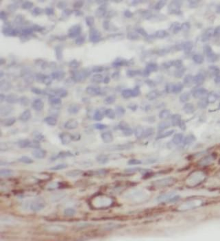 SERPINA3 Mouse Monoclonal Antibody