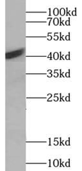 ACTC1 Antibody