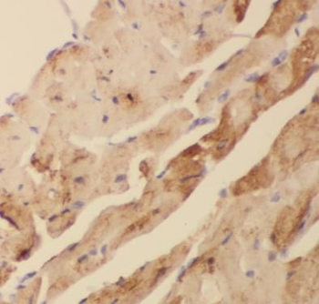 ACTC1 Antibody