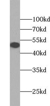 GLA Mouse Monoclonal Antibody