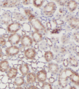 GLA Mouse Monoclonal Antibody