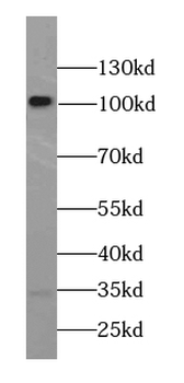 CTNNA2 Antibody