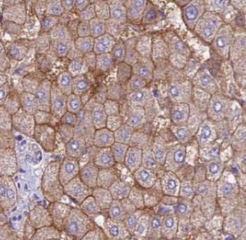 AMT Rabbit Polyclonal Antibody