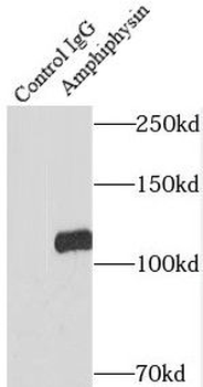 AMPH Antibody
