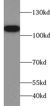 AMPH Antibody