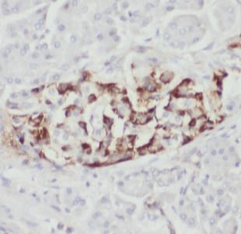 AMPH Antibody