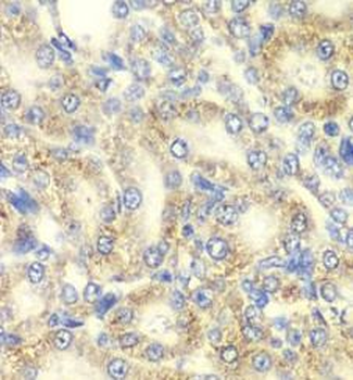 PRKAB2 Antibody