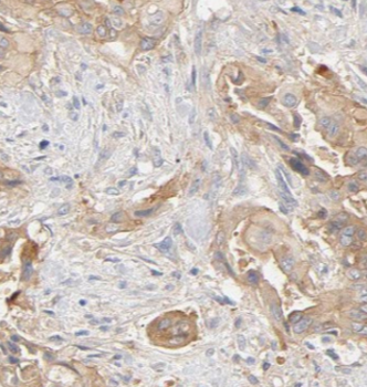 AMY2B Antibody