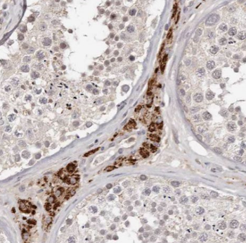 ANO10 Antibody