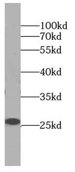 ARHGDIB Mouse Monoclonal Antibody