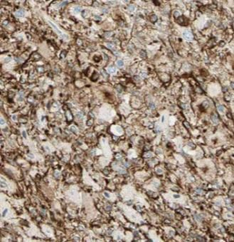 ARR3 Antibody