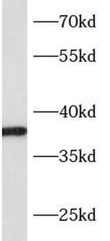 SLC10A2 Antibody
