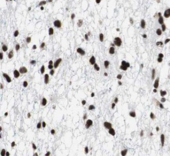 SRSF1 Antibody