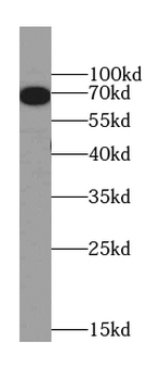ATF2 Specific Rabbit Polyclonal Antibody