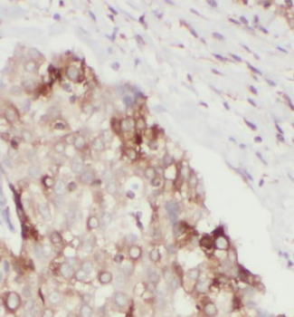 ATF2 Specific Rabbit Polyclonal Antibody