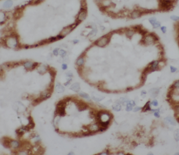 ATP1A1 Antibody