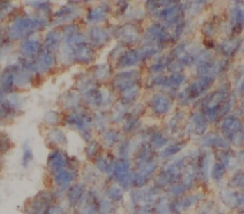 ATP5F1C Antibody