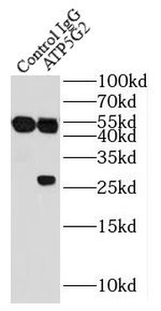 ATP5MC2 Antibody