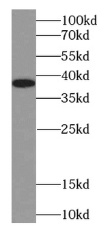 NPM1 Rabbit Polyclonal Antibody