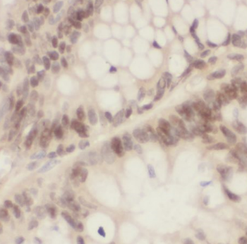 NPM1 Rabbit Polyclonal Antibody