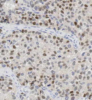 NPM1 Antibody