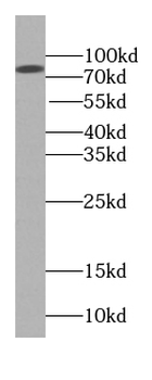 BBS2 Antibody