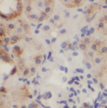 ARL6 Antibody