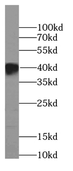 BBS5 Mouse Monoclonal Antibody