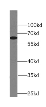 MKKS Antibody