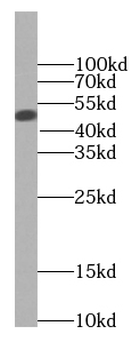 BCS1L Antibody