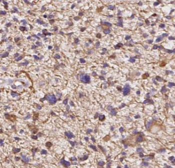 BCS1L Antibody