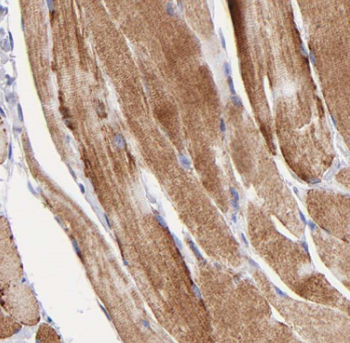 BEST3 Antibody