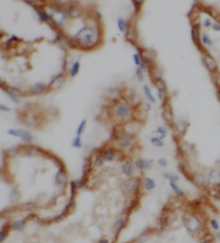 SH3GLB1 Antibody