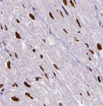 BRD8 Antibody