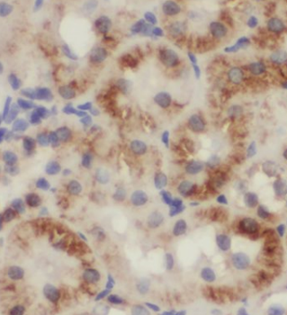 UQCC3 Antibody