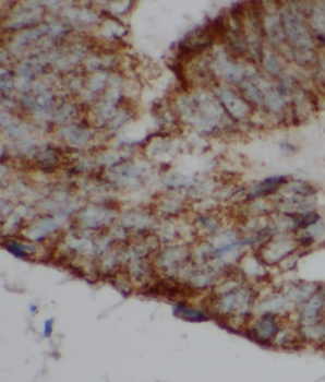 SMCO3 Antibody