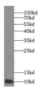 MCRIP2 Rabbit Polyclonal Antibody